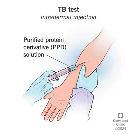 walgreens ppd test